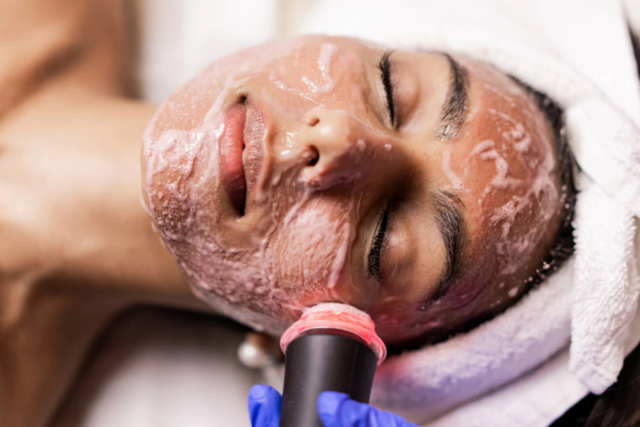 OXY GENEO CO2 – Rewolucyjne dotlenienie i odżywienie skóry